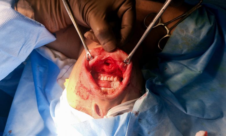 Robotic surgery provides aesthetic and cosmetic surgery