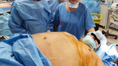 Photo of लखनऊ पीजीआई मे 150 किलो वजन के मरीज में पेसमेकर लगाया गया
