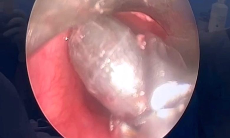 सीने में फँसी गोली